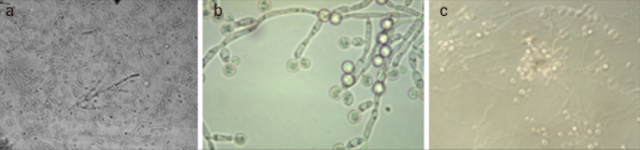 酵母，青霉素等在光学显微镜下的外观