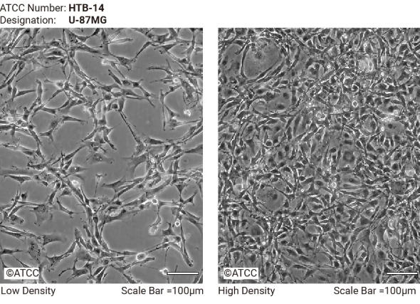 U-87 MG 细胞低密度和高密度生长形态