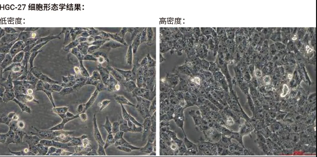 HGC-27 细胞低密度和高密度生长形态