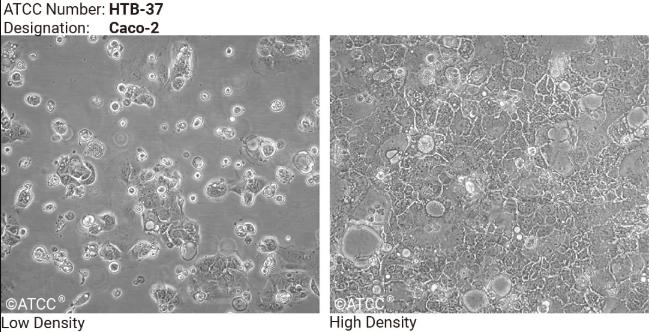 Caco2 细胞低密度和高密度生长形态