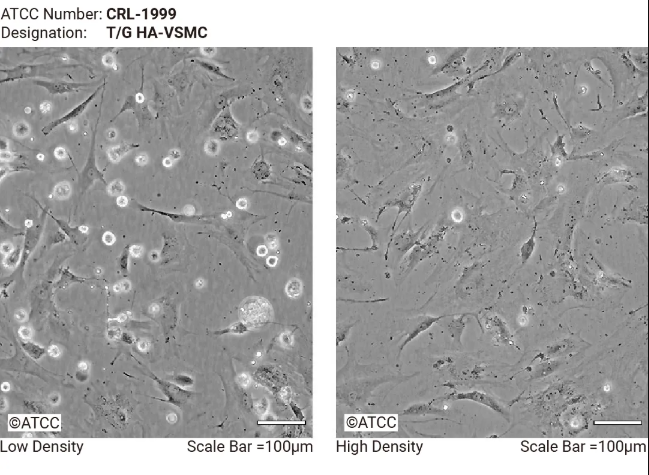 VSMC 细胞低密度和高密度生长形态