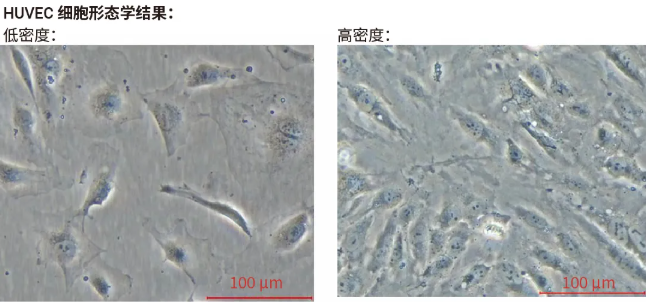HUVEC 细胞低密度和高密度生长形态