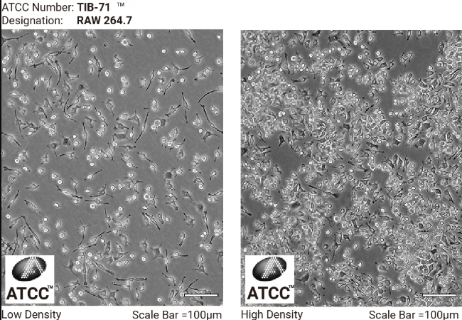 RAW264.7 细胞低密度和高密度生长形态
