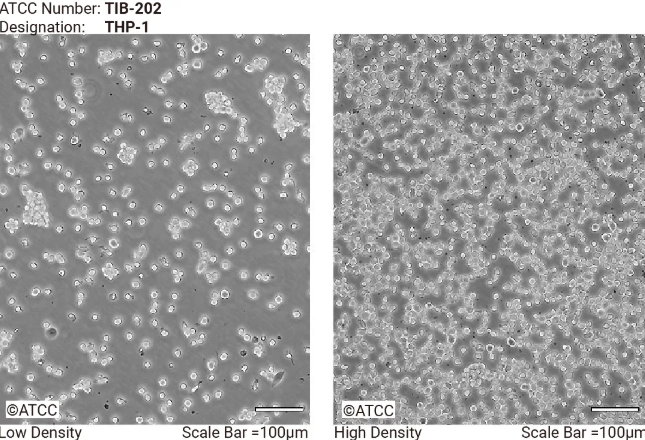 THP-1 细胞低密度和高密度生长形态